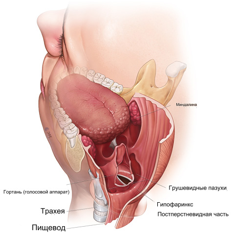 Гипофарингеальный рак диагностика